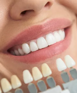 Teeth Whitening